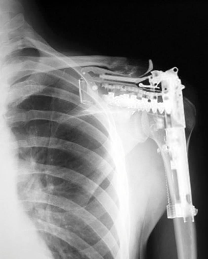 gun xray Pictures, Images and Photos