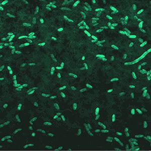 quorum sensing expression